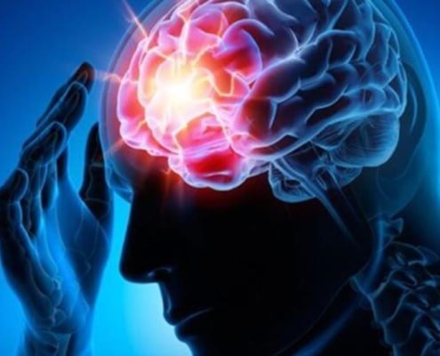 Çocuklarda Epilepsi Nedir