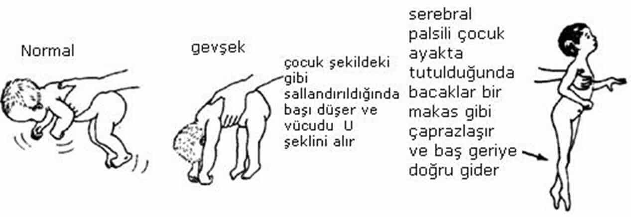 Beyin-Felci